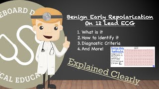 Benign Early Repolarization On Actual 12 Lead ECG  Identifying Diagnostic Criteria And More [upl. by Yoho382]