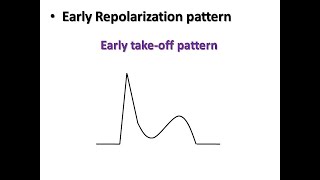 ECG course STEMI or Early Repolarization Pattern Dr Sherif Altoukhy [upl. by Ahsiekyt]