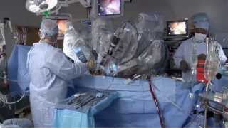 Laparoscopic vs Robotic [upl. by Maddi72]