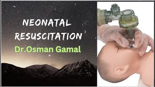 Neonatal Resuscitation  for NICU physicians [upl. by Yaned]