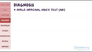 Peripheral Artery Disease  Osmosis [upl. by Eissahc]