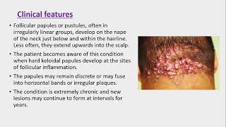 Lecture200 Acquired disorders of Pilosebaceous units Rooks chapter 93 [upl. by Eiro]