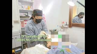 Hmelthatna Microneedling leh Platelet Rich Plasma PRP Mizo Skin Clinic  Chanmari 2 Lunglei [upl. by Plate364]