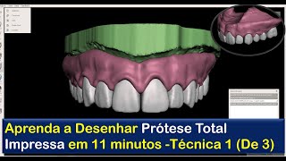 Como Fazer PRÓTESE TOTAL Para Imprimir Em Passos de 11 min [upl. by Anilec410]