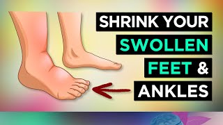 6 Ways To SHRINK Your SWOLLEN FEET amp ANKLES Remedies [upl. by Ecinerev]