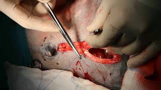 Splenectomy in a dog [upl. by Ives]