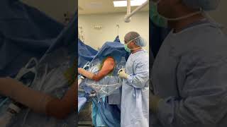 Shoulder arthroscopy setup 1 [upl. by Keithley]