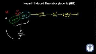 Heparin Induced Thrombocytopenia HIT Explained  MADE EASY [upl. by Otes292]