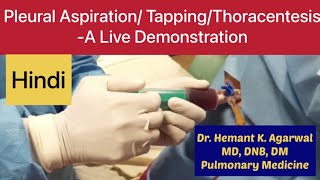 Pleural Aspiration Pleural Tapping Thoracentesis Needle Pleurocentesiss HINDI [upl. by Marni]