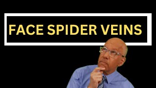 How to Treat Spider Veins on the Face 5 Essential Facts for Doctors and Nurses [upl. by Philippe]