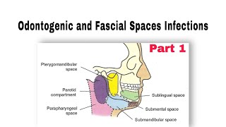 Odontogenic and Fascial Spaces Infections طب الأسنان مرحلة رابعة oralsurgery [upl. by Eeleak]