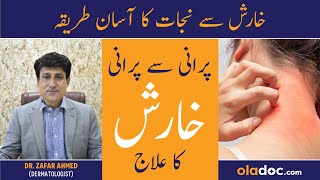 Kharish Khatam Karne Ka Tarika  Scabies Ka Ilaj In Urdu  Itching Treatment  Kharish Ka Fori Ilaj [upl. by Waldemar588]