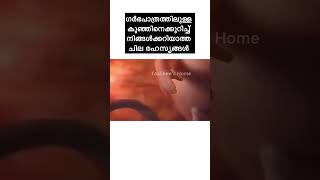 അവസാനത്തെ secret മിസ് ചെയ്യല്ലേ🤰💯malayalam womb pregnant fetusdevelopment pregnancyvlog [upl. by Lewin]