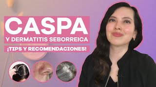 CASPA Dermatitis seborreica lo que tienes que saber [upl. by Fleta]