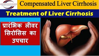 Treatment of liver cirrhosis  chronic liver disease  compensated cirrhosis [upl. by Cordelie]