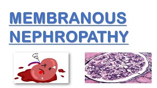 Membranous Nephropathy  Nephrotic Syndrome  Made Easy [upl. by Martella]