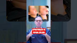 ASSISTA ESSE VÍDEO ANTES DE FAZER UMA LIPOASPIRAÇÃO DE PAPADA shorts [upl. by Barbi441]