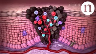 Tumour immunology and immunotherapy [upl. by Heshum]