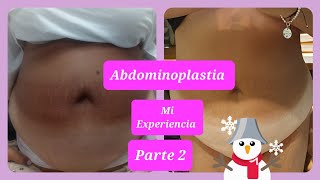 Abdominoplastia 2 [upl. by Stein]