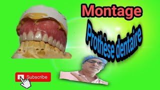 Prothèsedentaire Montage prothèse dentaire du haut [upl. by Leynad109]