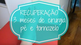 PÓS OPERATÓRIO CIRURGIA PÉ E TORNOZELO  3 MESES DEPOIS  Juliana Palma [upl. by Enitsej323]