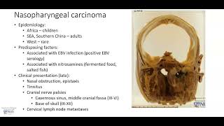 Nasopharynx Nasopharyngeal carcinoma Gross pathology [upl. by Edythe]