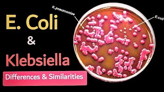 Difference between E coli and Klebsiella 🧫 lactose fermentor enterobacteriaece 🔬 [upl. by Ahsienat25]