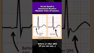 Junctional Rhythms ECG Nursing Mnemonic NCLEX EKG Review [upl. by Plunkett]