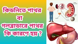 কিডনিতে পাথর বা গলব্লাডারে পাথর কি কারনে হয়   What causes kidney stones and gallbladder stones [upl. by Gabby]