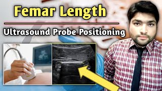 Femur Length Ultrasound  The Complete Guide to Probe Positioning for Accurate Fetal Growth [upl. by Us]