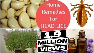 Top 5 Home Remedies To Get Rid Of Head LICE amp Nits  Sushmitas Diaries [upl. by Kendyl]