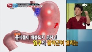 더 이상 급체는 민간의학에 의지하지 않아도 돼 닥터의 승부 91회 [upl. by Ive534]