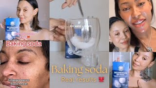 Baking soda skincare  Pigmentation Glass skin Even skintone Real people compilation 🎀 [upl. by Enaira]