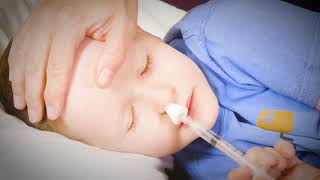 How to Give Your Child Nasal Midazolam [upl. by Nas]