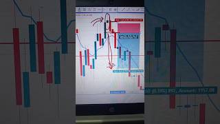 Doji Candle Big PROFIT Strategy💲🤑  Options Trading strategies for beginners trading nifty shorts [upl. by Huai597]