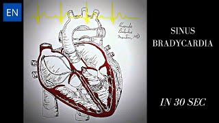 Sinus Bradycardia Animation and ECG Shorts [upl. by Nirrek443]