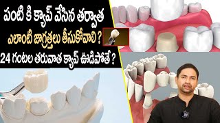 Precautions to Take After Dental Capping  When To Remove Dental Crowns  Way2Health [upl. by Llert142]