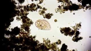 Wimpertierchen  Ciliophora  Ciliata  Ciliate  microorganisms under microscope microcosmos [upl. by Aniroc]