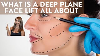 What is a deep plane face lift all about [upl. by Elatsyrk955]