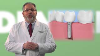 What You Need to Know About Tooth Grinding [upl. by Reitrac]