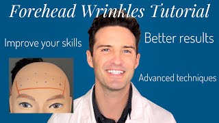 Forehead Wrinkles Treatment Tutorial beginner and advanced [upl. by Hagi]