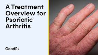 A Treatment Overview for Psoriatic Arthritis  GoodRx [upl. by Leimad]