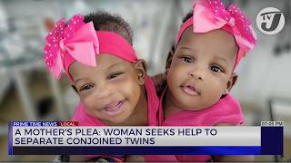 A Mothers Plea Woman Seeks help to Separate Conjoined Twins  TVJ News [upl. by Narol]