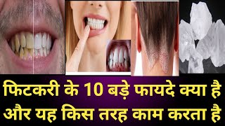 Fitkari treatment फिटकरी के 10 बडे फायदे क्या है जानीऐ इस वीडियोज मे। [upl. by Oiluj683]