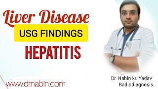 USG LIVER HEPATITIS BY Dr Nabin drnabin india ultrasound doctor internationaldoctor yt [upl. by Zedecrem]