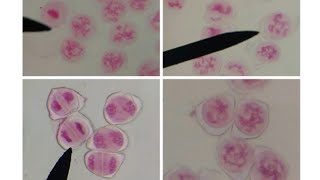 MEIOTIC CELL DIVISION STAGES FROM PERMANENT SLIDES SPECIMEN  GRASSHOPPER TESTIS [upl. by Ayyn]