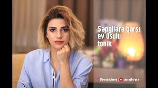 Səpgi və sızanaqlara qarşı ev üsulu tonik [upl. by Dorris]