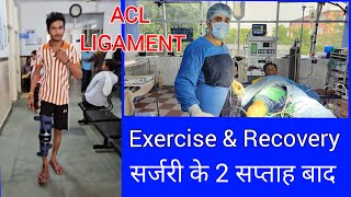 ACL LIGAMENT FRACTURE EXERCISE AND RECOVERY AFTER 2 Weeks aclligament [upl. by Talley]