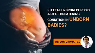 Is fetal hydronephrosis a lifethreatening condition in unborn babies Dr Sunil Kumar G Sunborn [upl. by Howard226]