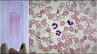 Blood Smear Preparation and Staining Practical Lab [upl. by Enneira]